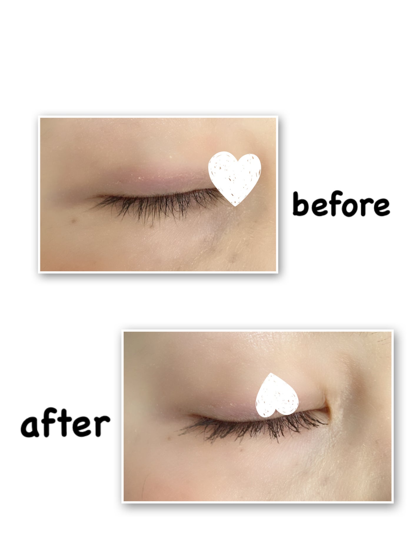 リップ&アイメイクリムーバー/ETUDE/ポイントメイクリムーバーを使ったクチコミ(7枚目)