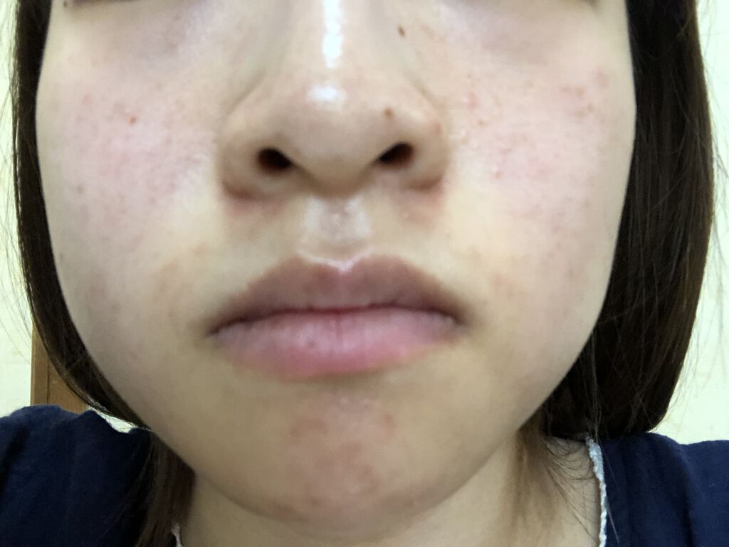 グリーンティーシード エッセンスインローション/innisfree/乳液を使ったクチコミ（3枚目）