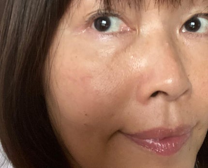 スキンエッセンス/Reductio/美容液を使ったクチコミ(4枚目)