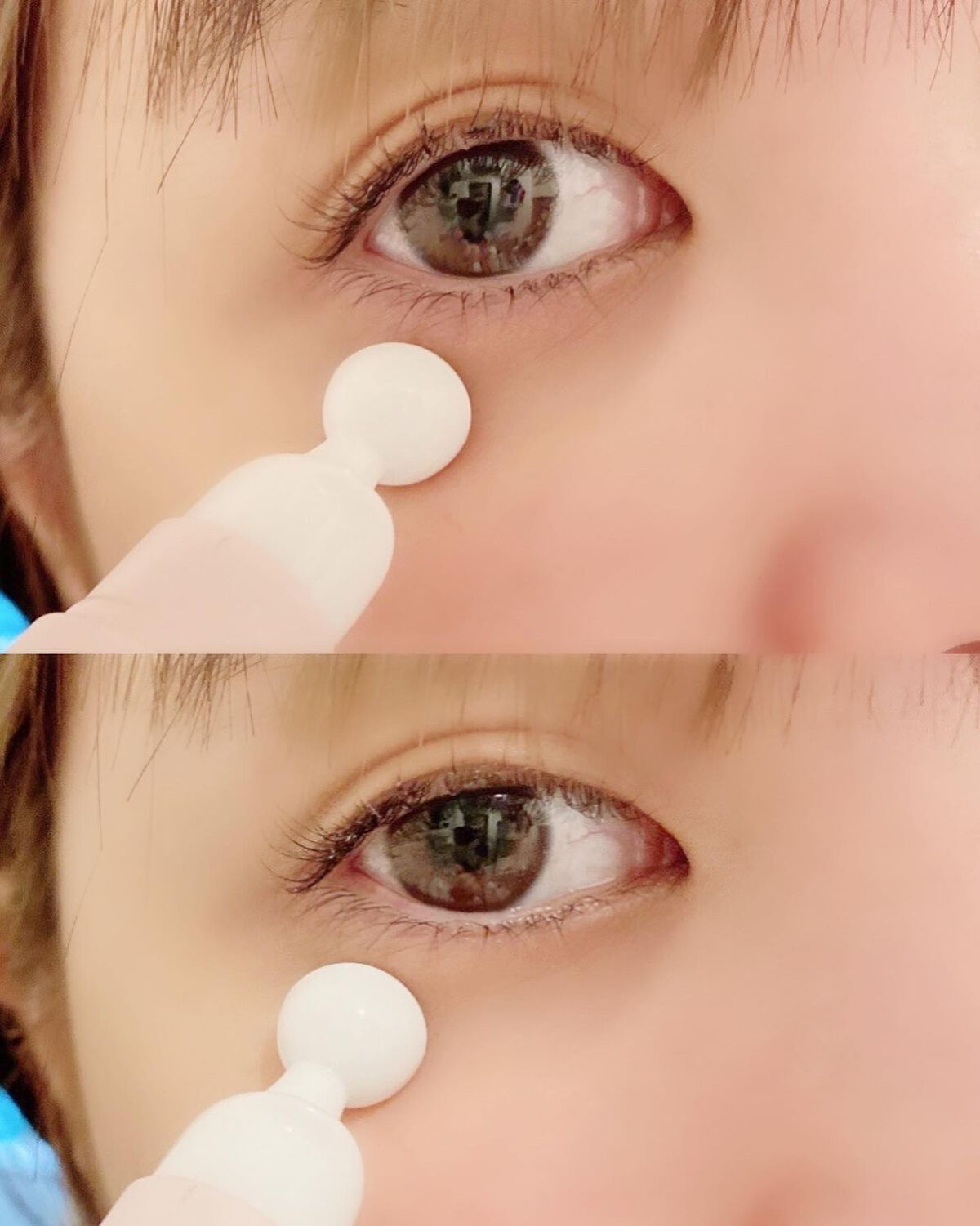 チェリーブロッサム ブレミッシュ 8GF スティック アイクリーム/Bring Back/アイケア・アイクリームを使ったクチコミ(6枚目)