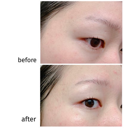 サロンプラス トーンアップ フェイススムーサー ホルダー(刃付き)/サロンプラス/シェーバーを使ったクチコミ(8枚目)