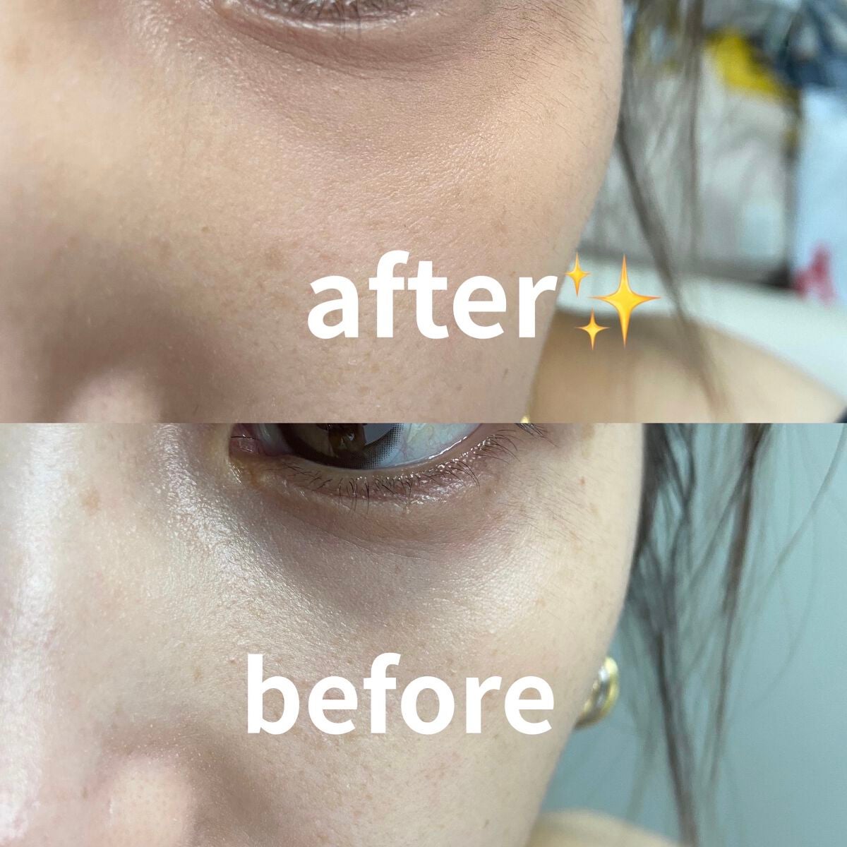 リシェ レッドトリック アイコンシーラー/Visée/パレットコンシーラーを使ったクチコミ(3枚目)