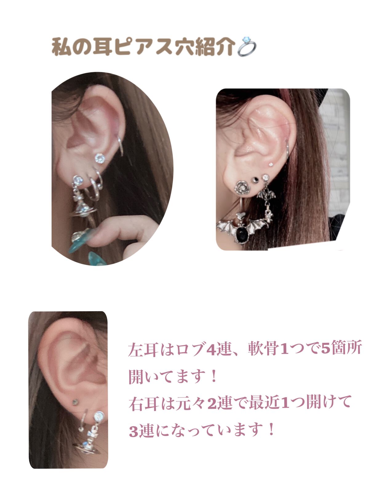 ドルマイシン軟膏(医薬品)/ゼリア新薬工業/その他を使ったクチコミ(2枚目)