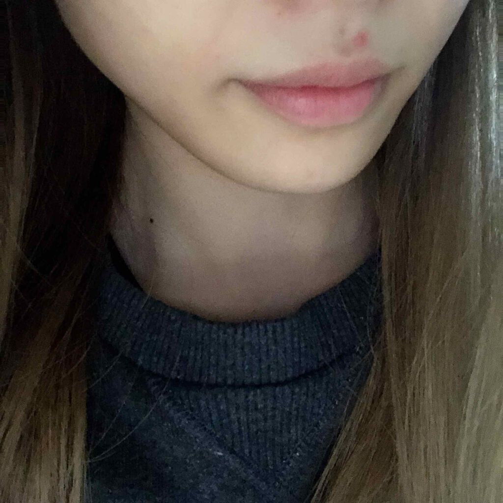 オバジC5セラム/オバジ/美容液を使ったクチコミ(2枚目)