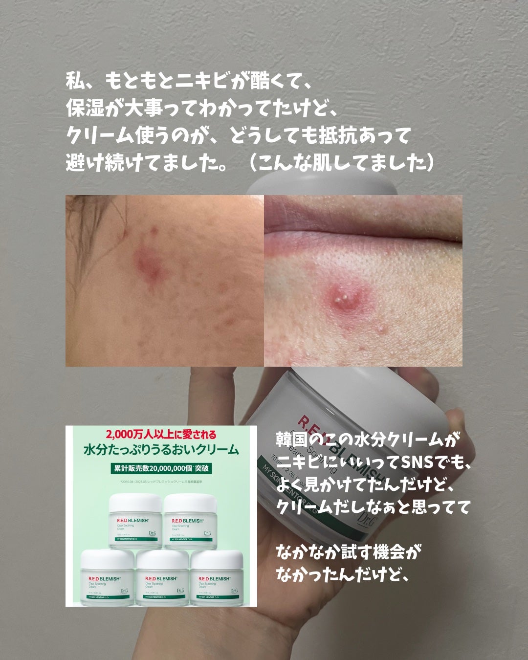 レッドブレミッシュ クリアスージングクリーム/Dr.G/フェイスクリームを使ったクチコミ(2枚目)