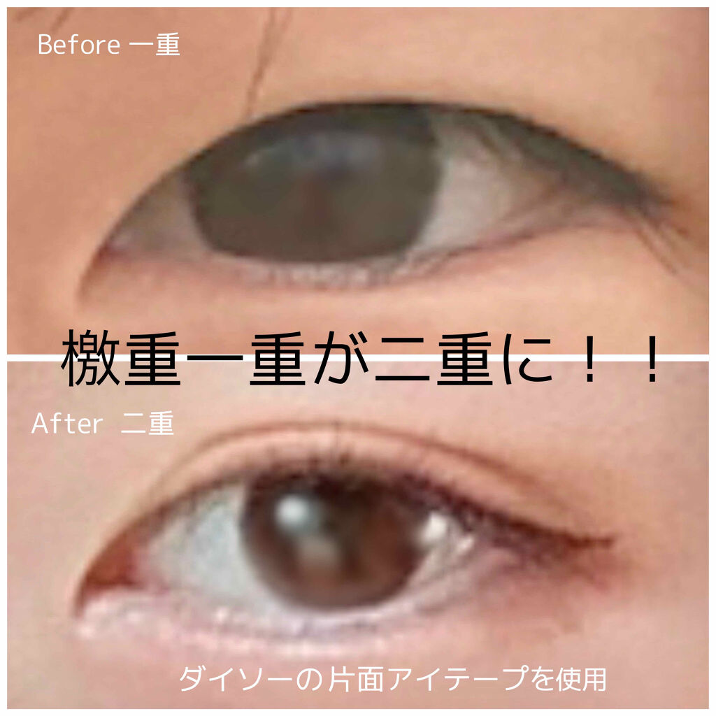 のびーるアイテープ（絆創膏タイプ、レギュラー）/DAISO/二重まぶた用アイテムを使ったクチコミ（1枚目）