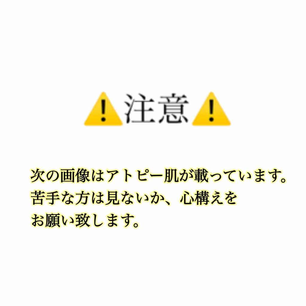 ピュアベール(医薬品)/プロペト/その他を使ったクチコミ(2枚目)