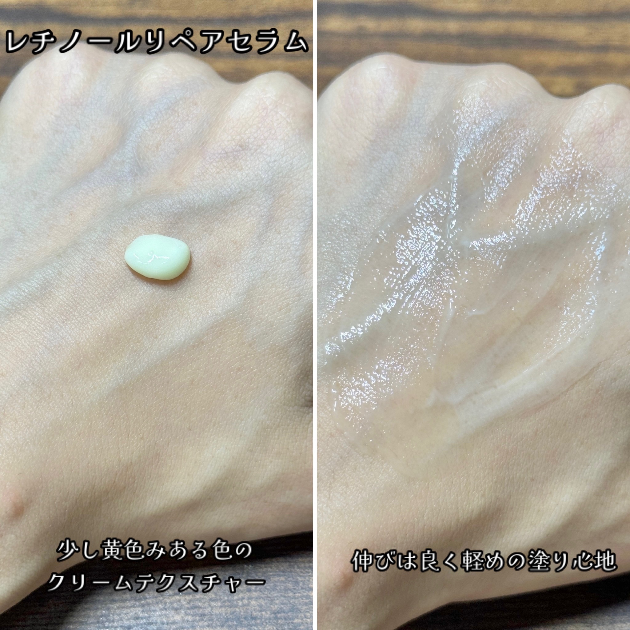 ヴィーガンリポソームレチノールセラム/SKIN&LAB/美容液を使ったクチコミ（3枚目）