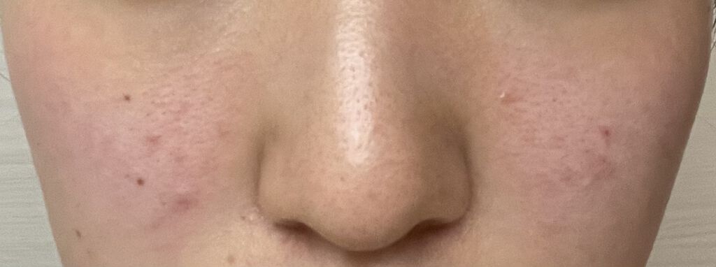 クリーム NA/なめらか本舗/フェイスクリームを使ったクチコミ（2枚目）