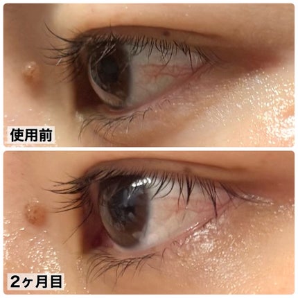 を使ったクチコミ(2枚目)