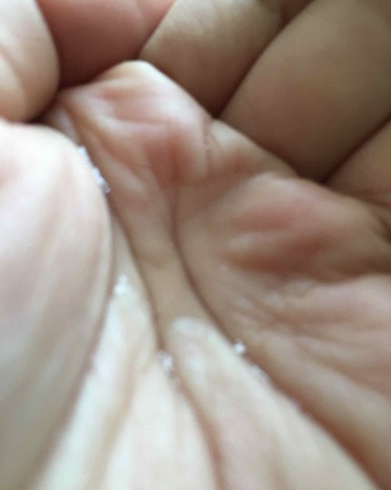 マイナチュレ 無添加育毛剤/マイナチュレ/頭皮ローションを使ったクチコミ(2枚目)