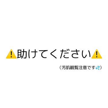 ラッシュ 艶肌ドロップのクチコミ「【⚠️助けてください⚠️】

おでこのニキビが酷いです
これ以上悪化しないうちに治したいです💦.....」（1枚目）