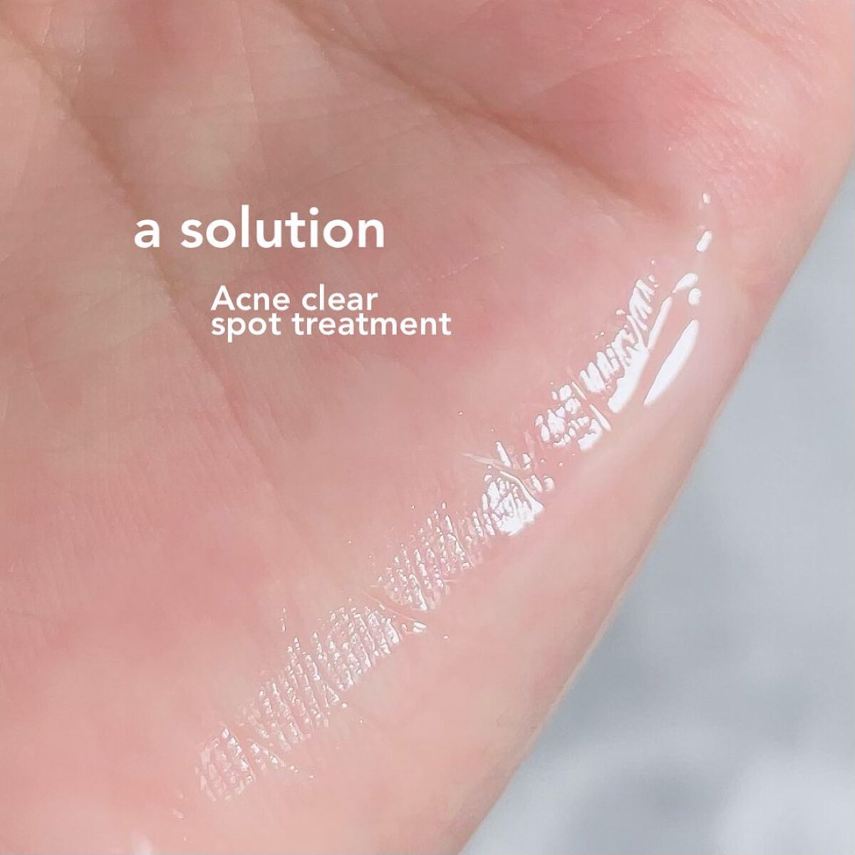 アクネクリアスポット トリートメント/a solution/その他スキンケアを使ったクチコミ（3枚目）