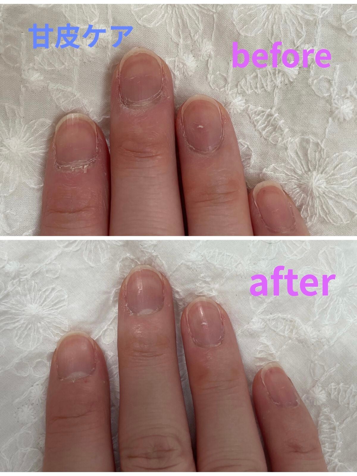 キューティクルトリマー/デュカート/ネイル用品を使ったクチコミ(1枚目)