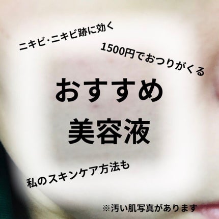ハトムギ化粧水(ナチュリエ スキンコンディショナー R )/ナチュリエ/化粧水を使ったクチコミ(1枚目)