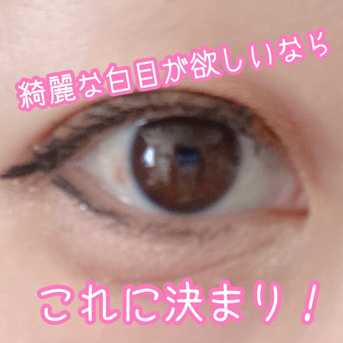 スマイルホワイティエn（医薬品）/ライオン/その他を使ったクチコミ（1枚目）