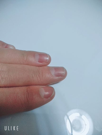 AC キューティクルオイル/AC MAKEUP/ネイルオイル・トリートメントを使ったクチコミ(2枚目)