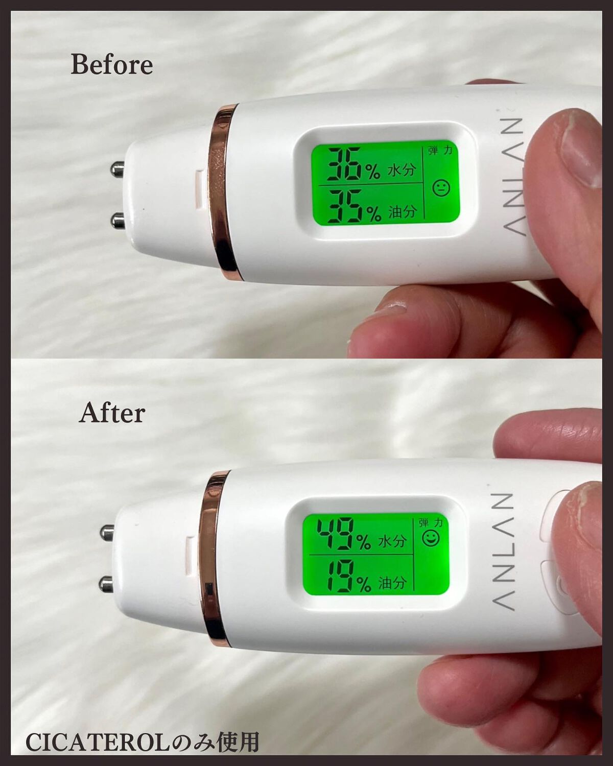 シカテロル美容液/beplain/美容液を使ったクチコミ(4枚目)