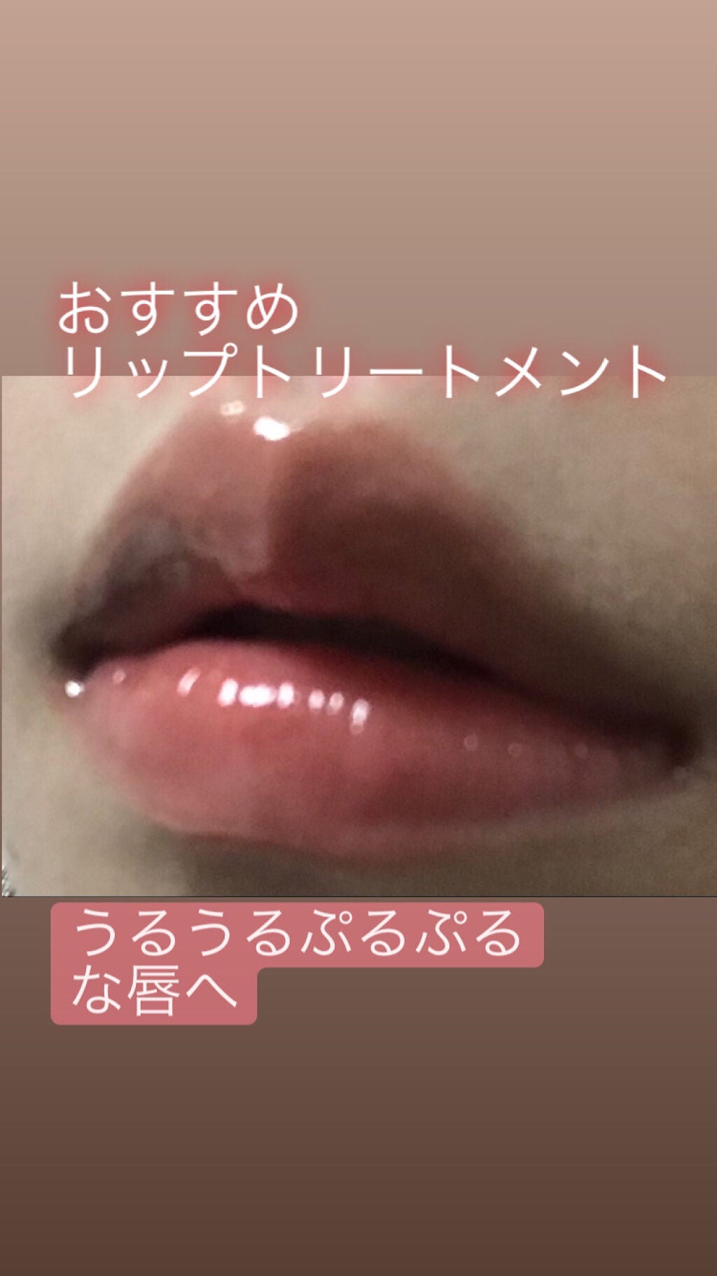 38°C / 99°F リップトリートメント (リップ美容液)/UZU BY FLOWFUSHI/リップケアを使ったクチコミ(1枚目)