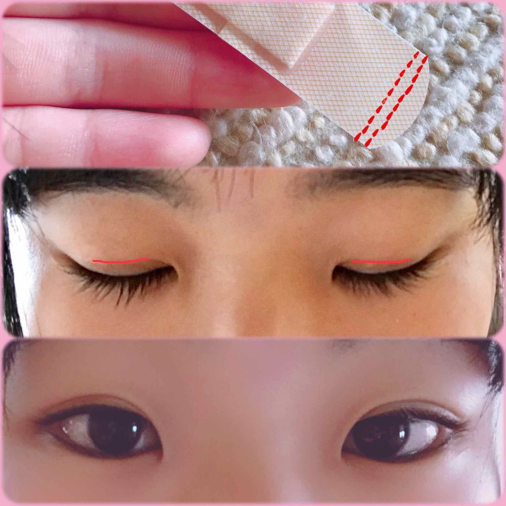 アイトーク/アイトーク/二重まぶた用アイテムを使ったクチコミ（3枚目）