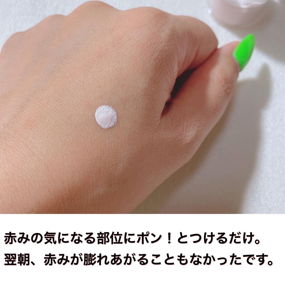 ピンクパウダースポットトリートメント/EUYIRA/その他スキンケアを使ったクチコミ(4枚目)