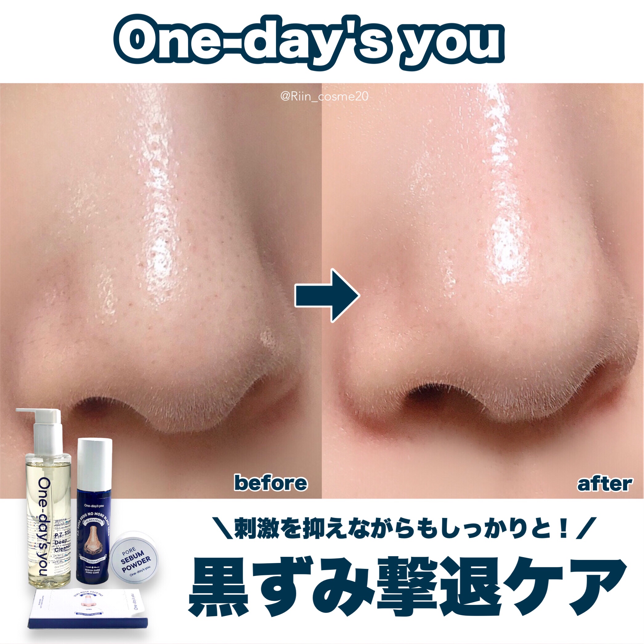 ノーモアブラックヘッド(ノーズピーリング)/One-day's you/スクラブ・ゴマージュを使ったクチコミ（1枚目）