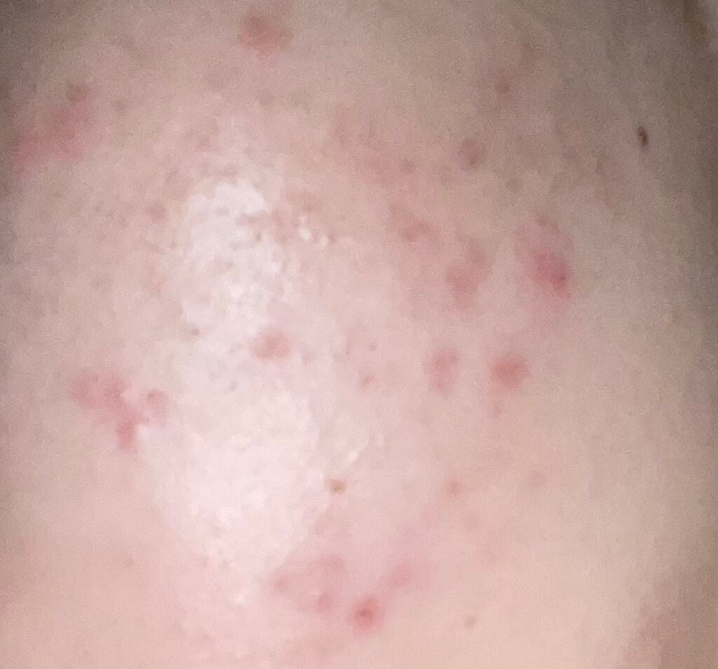 DHC はとむぎエキス/DHC/健康サプリメントを使ったクチコミ(1枚目)