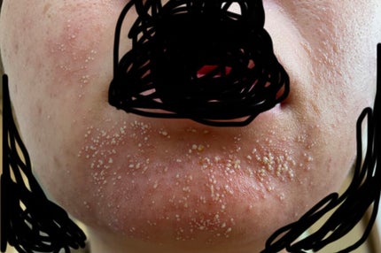 じんじゃー🫚 on LIPS 「2枚目、閲覧注意です合わない基礎化粧品でとんでもない事になって..」(2枚目)