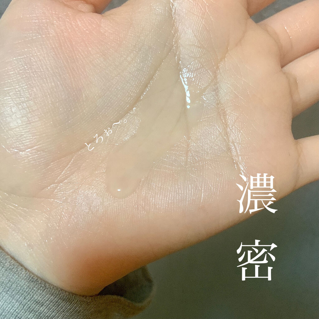 オルビスユー ローション/オルビス/化粧水を使ったクチコミ（2枚目）