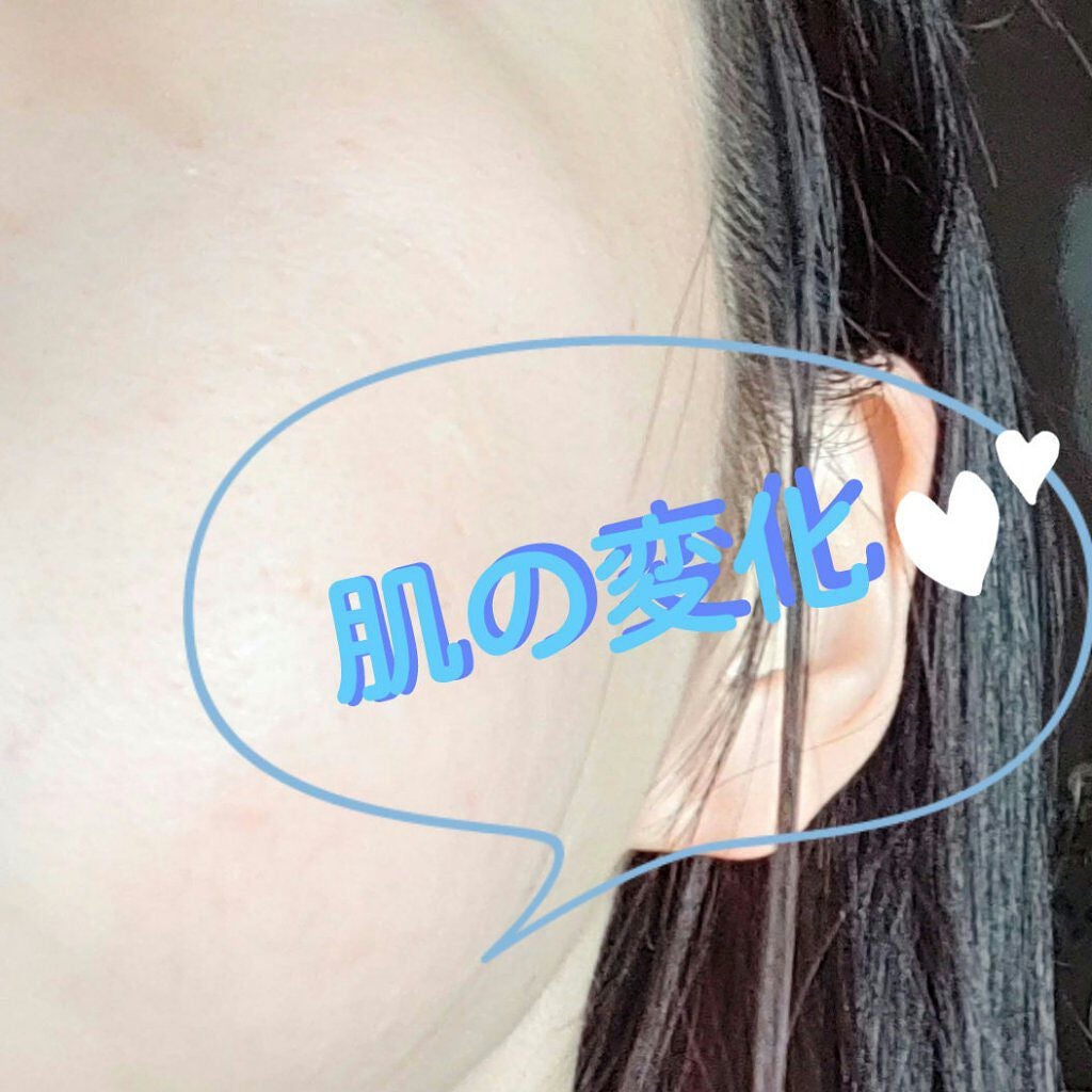 シナール イクシ(医薬品)/シオノギ製薬/その他を使ったクチコミ(1枚目)