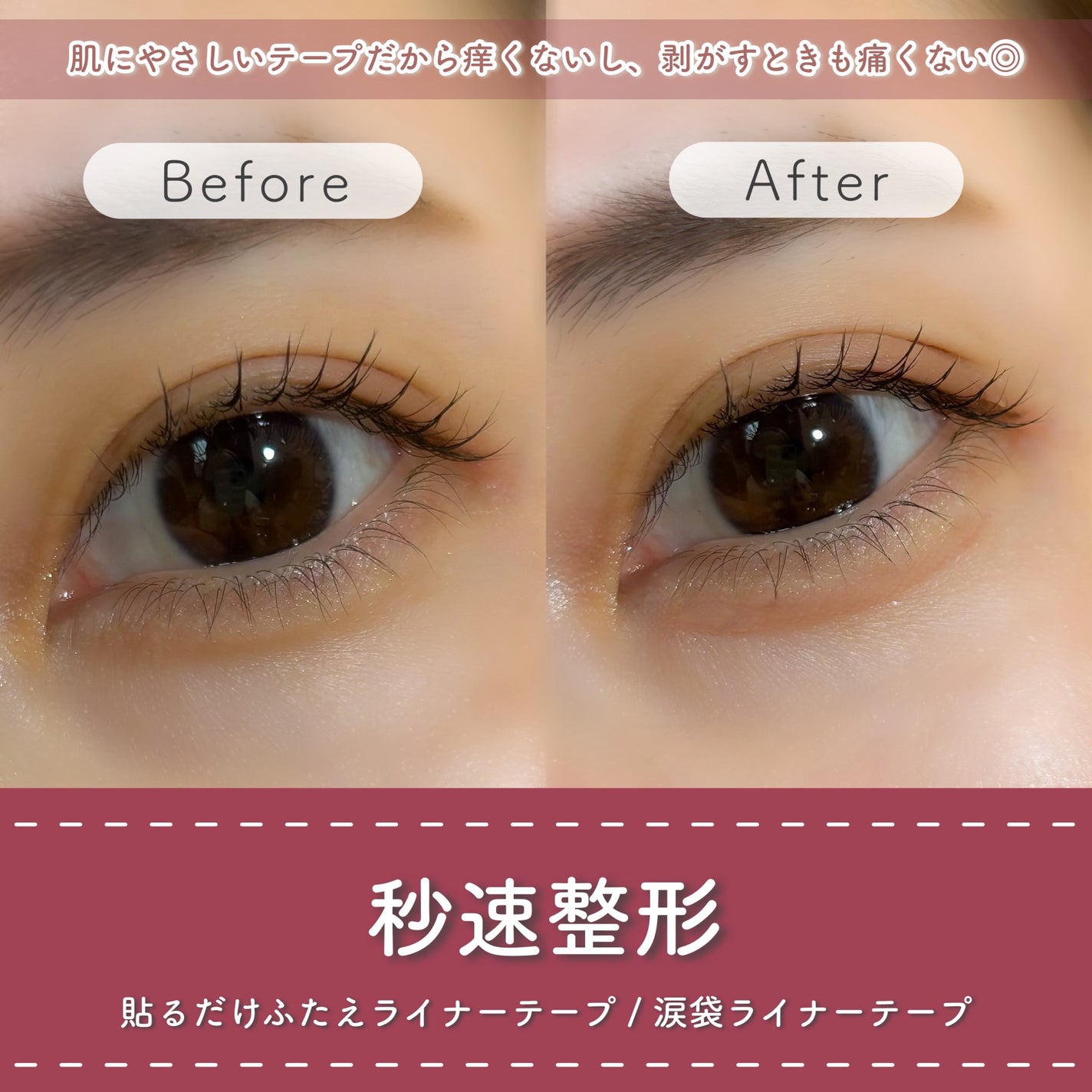 貼るだけふたえライナーテープ グレージュ/秒速整形/二重まぶた用アイテムを使ったクチコミ(5枚目)