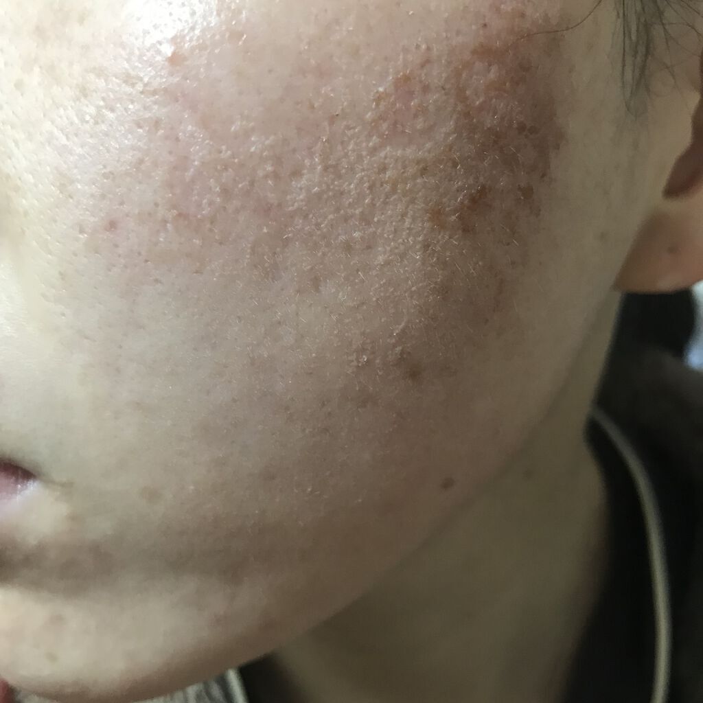 Cサスペンション23+HAスフィア2フェイスクリーム/The Ordinary/美容液を使ったクチコミ（2枚目）