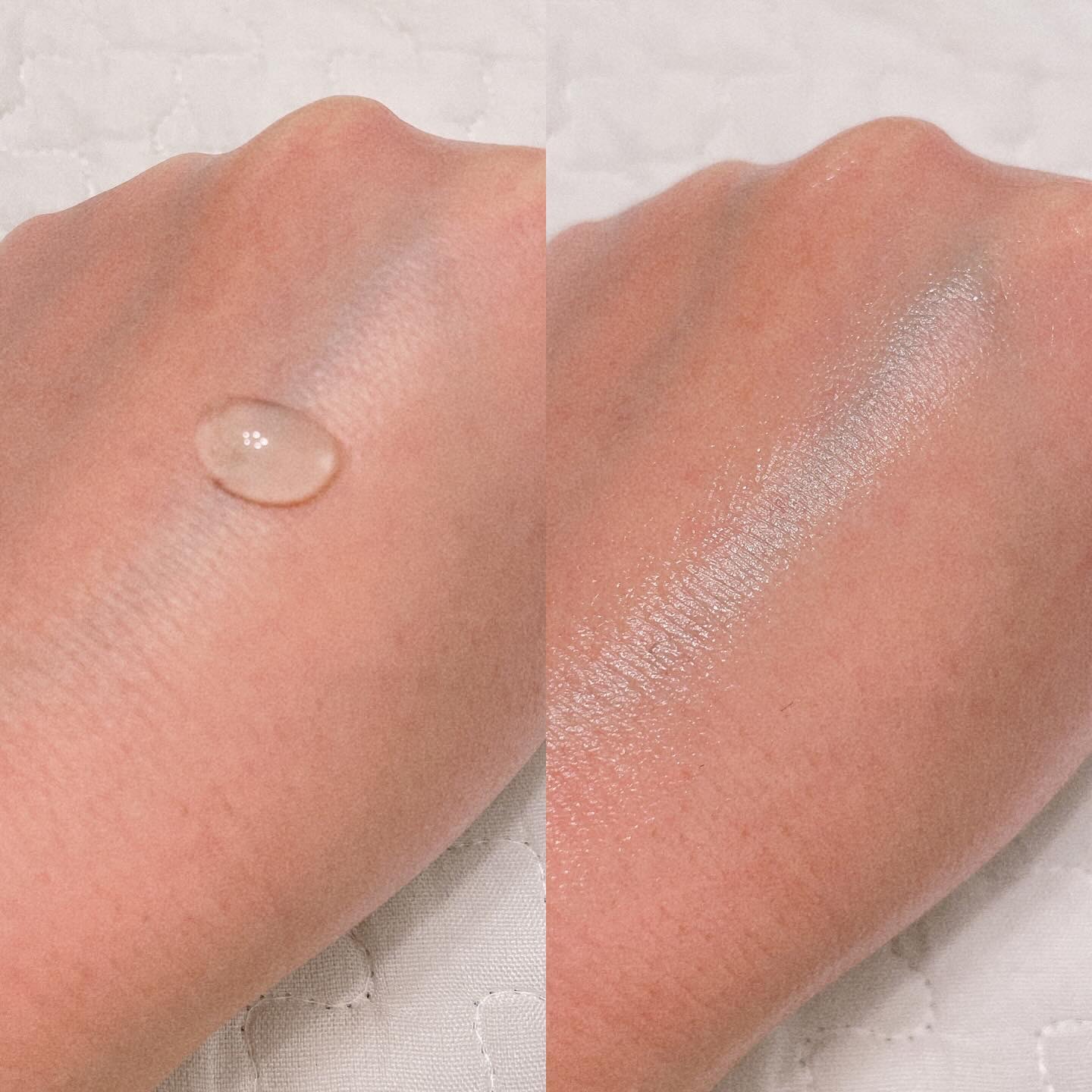 フィトシカノールB5 3000ショットセラム/MEDIPEEL/美容液を使ったクチコミ（2枚目）