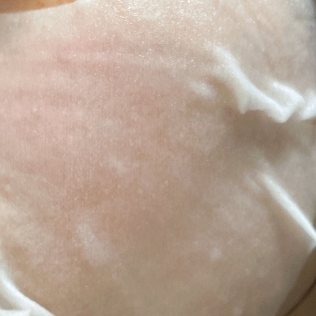 SUIKO HC ビタミン5エッセンスマスク/SUIKO HATSUCURE/シートマスク・パックを使ったクチコミ(4枚目)