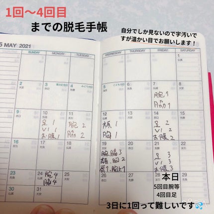 光脱毛器 VIO/Sarlisi/家庭用脱毛器を使ったクチコミ(7枚目)