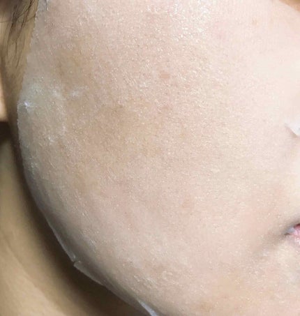 ミノン アミノモイスト ぷるぷるしっとり肌マスク/ミノン/シートマスク・パックを使ったクチコミ(9枚目)