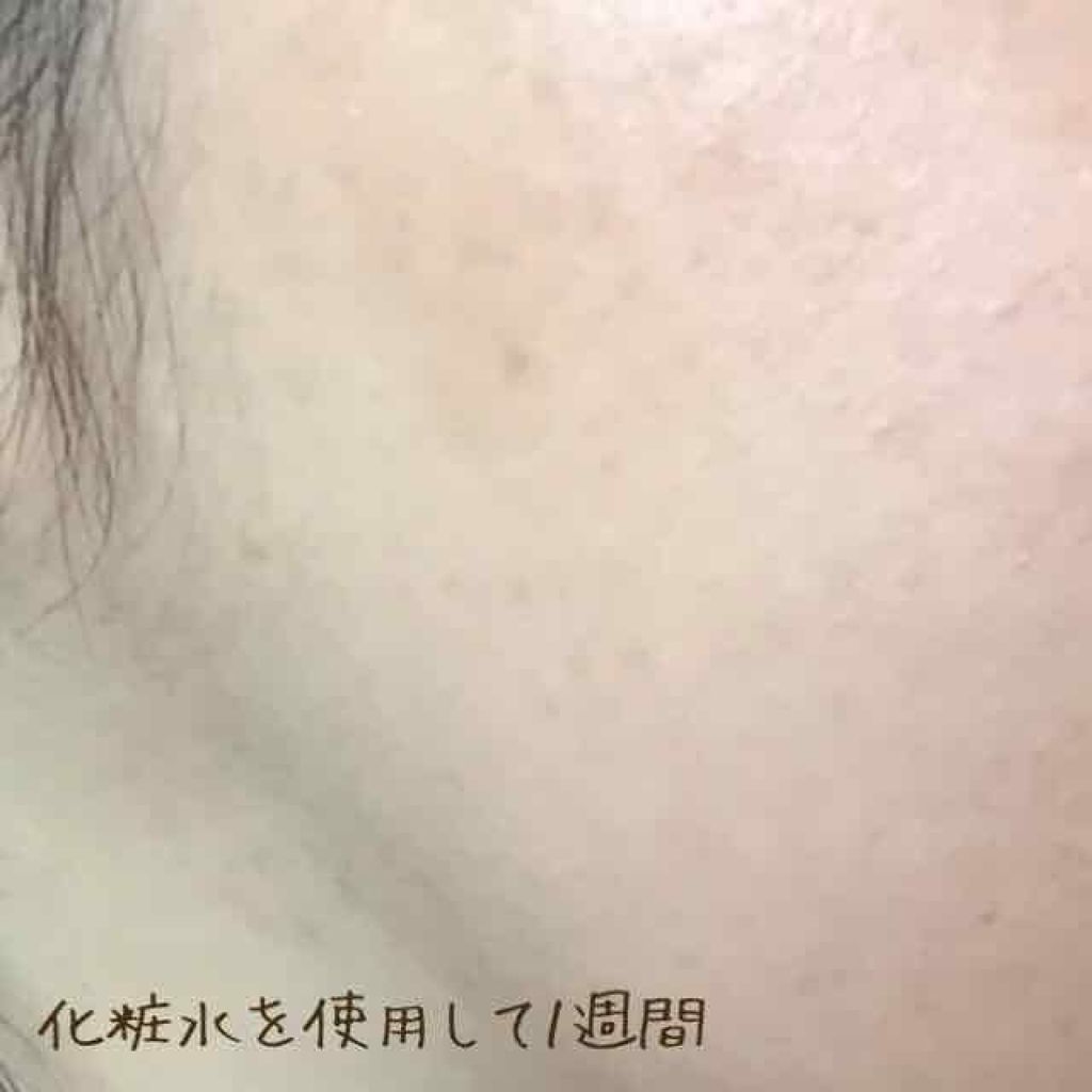 モイスチャーハーバルウォーター ラベンダー／カモミール 本体/MARKS&WEB/ミスト状化粧水を使ったクチコミ（3枚目）