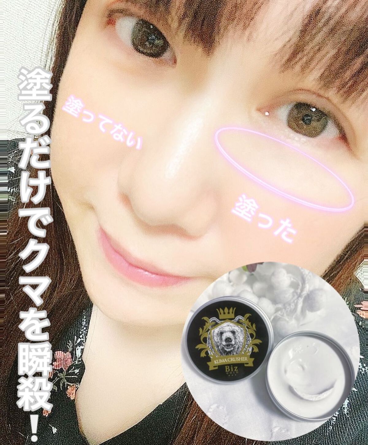 王様のクマクラッシャー/ビズゴールド/アイケア・アイクリームを使ったクチコミ（1枚目）