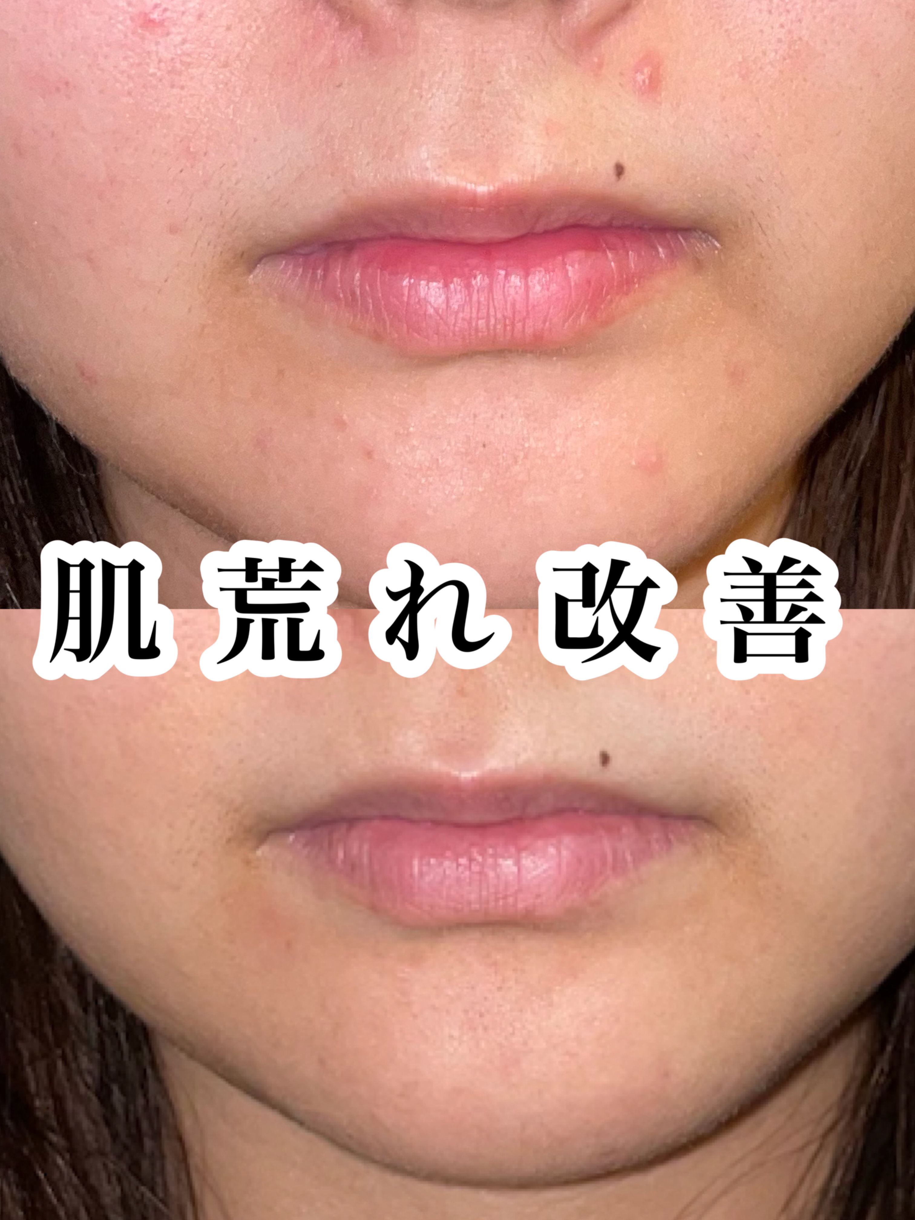 RXザ・レチノール0.1クリーム/COSRX/フェイスクリームを使ったクチコミ（1枚目）