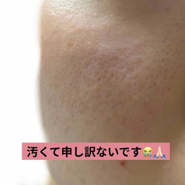 敏感肌用薬用美白美容液/無印良品/美容液を使ったクチコミ（2枚目）