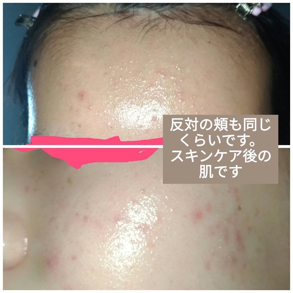 UVミルクEX/NOV/日焼け止めミルクを使ったクチコミ(2枚目)