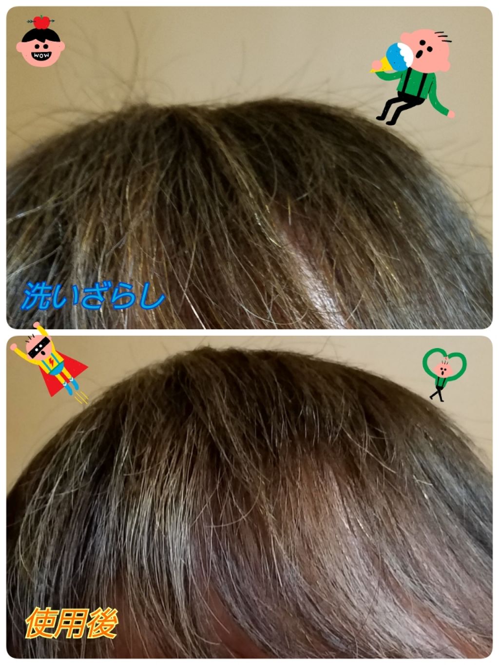 ストレートヒートブラシ スリム /SALONIA/ヒートブラシを使ったクチコミ（2枚目）