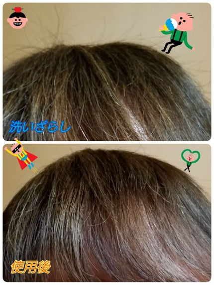 ストレートヒートブラシ スリム /SALONIA/ヒートブラシを使ったクチコミ(2枚目)