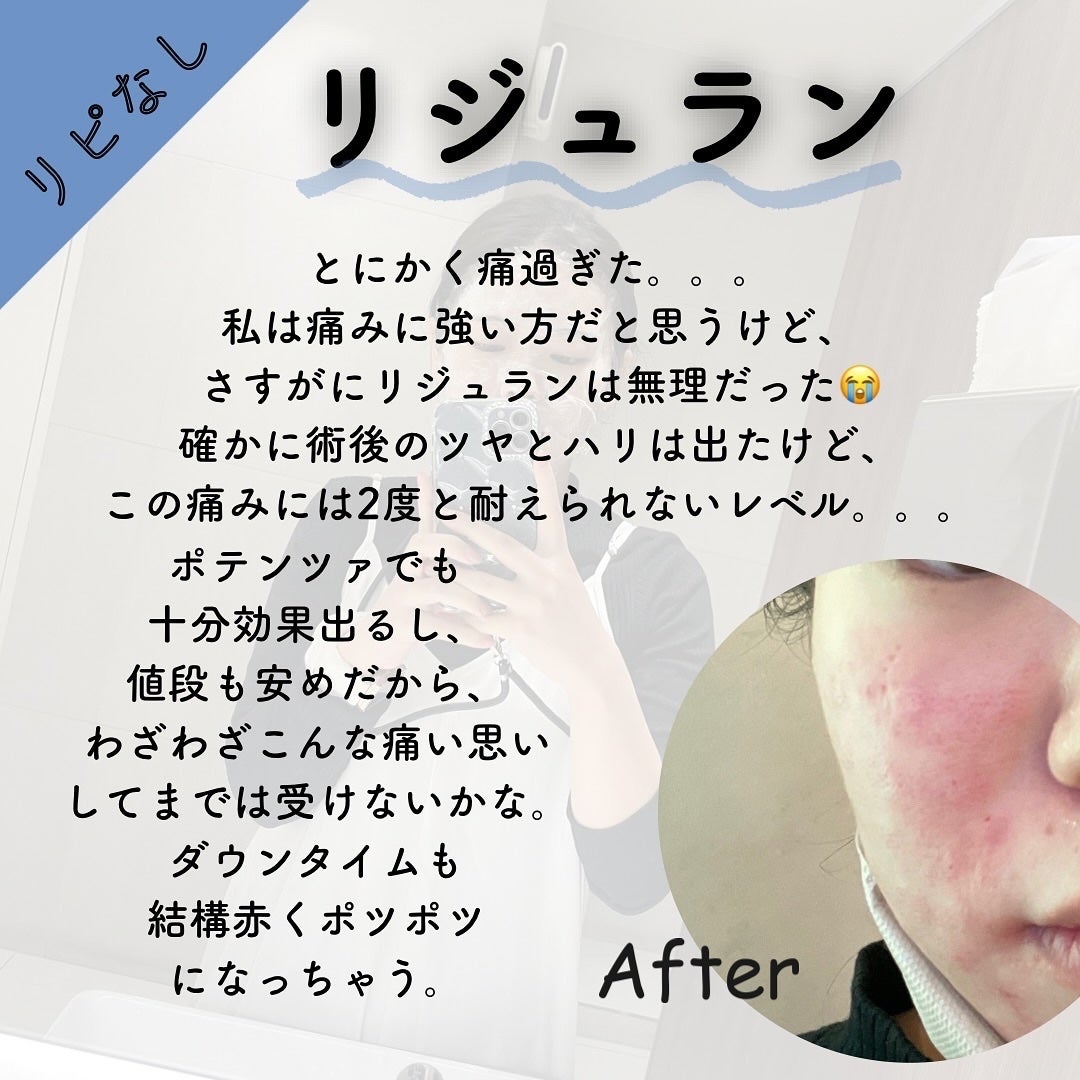 ðððð€ËË on LIPS ããªãããã»ãªããªãçŸå®¹å»çâ»éžïŒã³ããçŠãæããŠçŸå®¹å»çã«ã..ãïŒ6æç®ïŒ