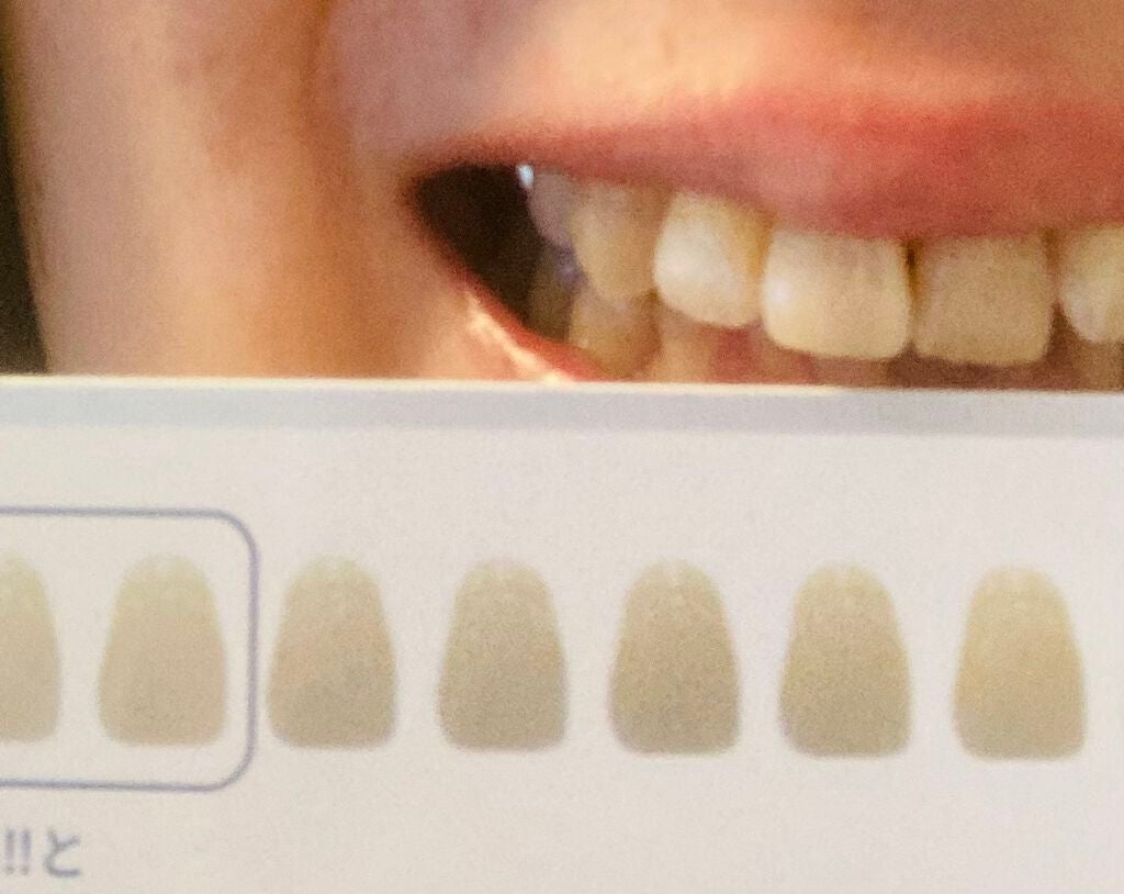 ホワイティエッセンス/MiiS/その他オーラルケアを使ったクチコミ(3枚目)