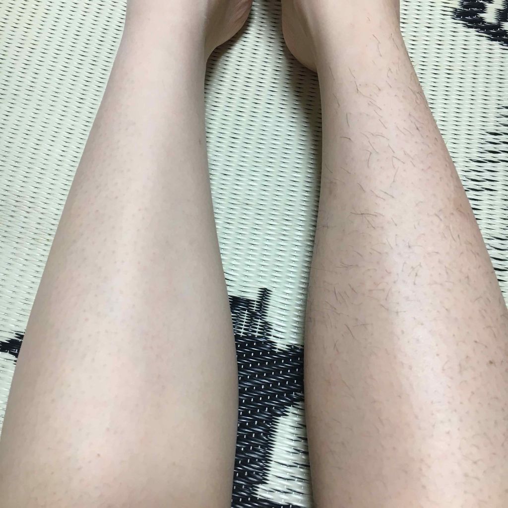 スムーズスキン/DAISO/ムダ毛ケアを使ったクチコミ（3枚目）