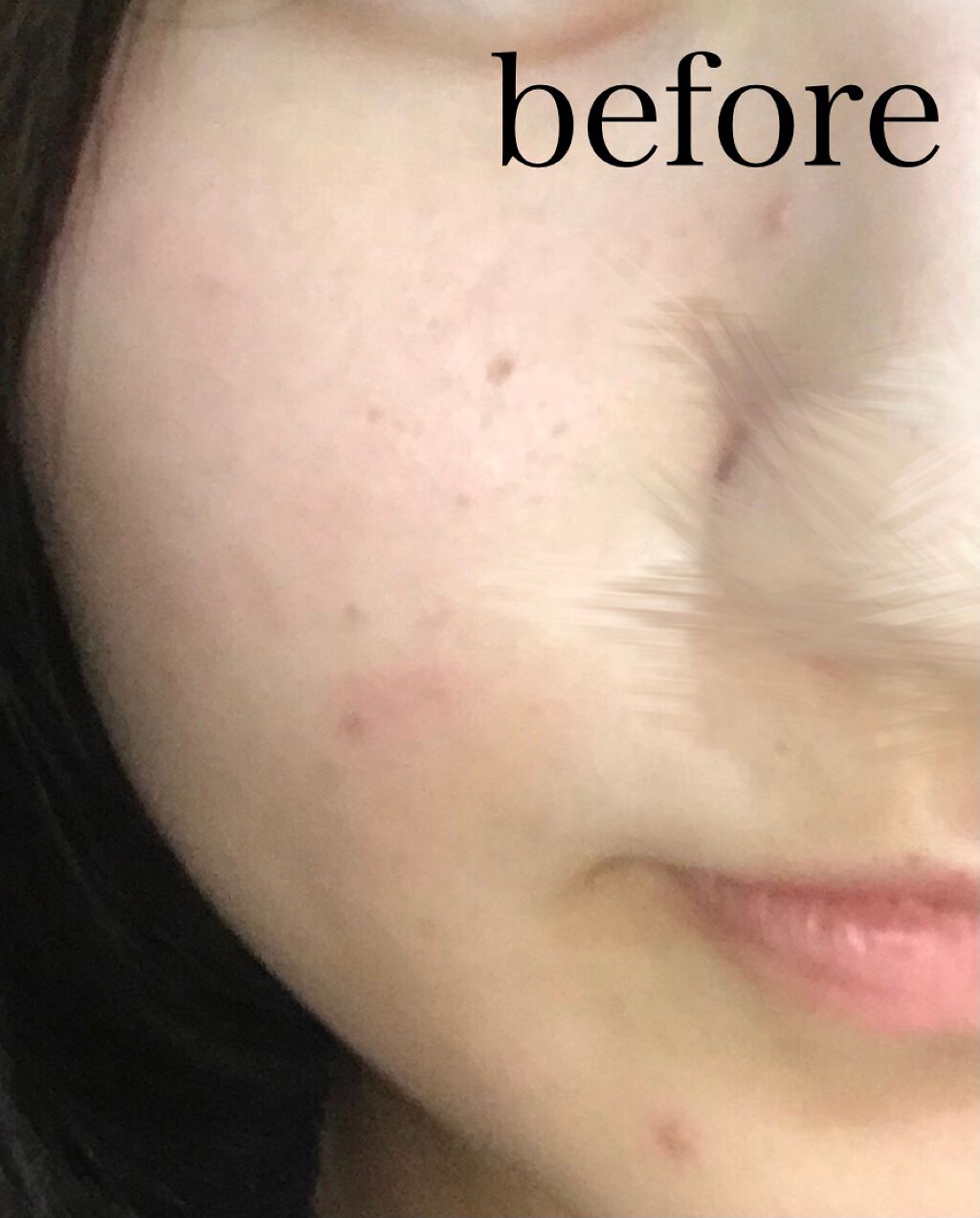 モイストバランス ローション/ACSEINE/化粧水を使ったクチコミ(2枚目)