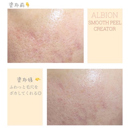 ❃miho❃ on LIPS 「毛穴対策用下地をお探しのあなたへ。♕𝙱𝚊𝚜𝚎♕————————..」(2枚目)