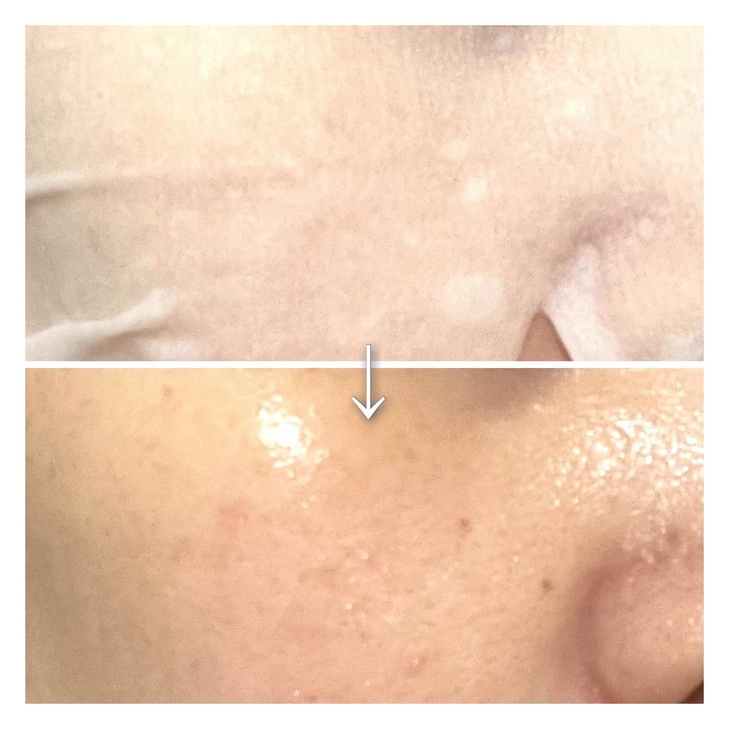 ルルルンプレシャス GREEN(バランス)【旧】/ルルルン/シートマスク・パックを使ったクチコミ(7枚目)