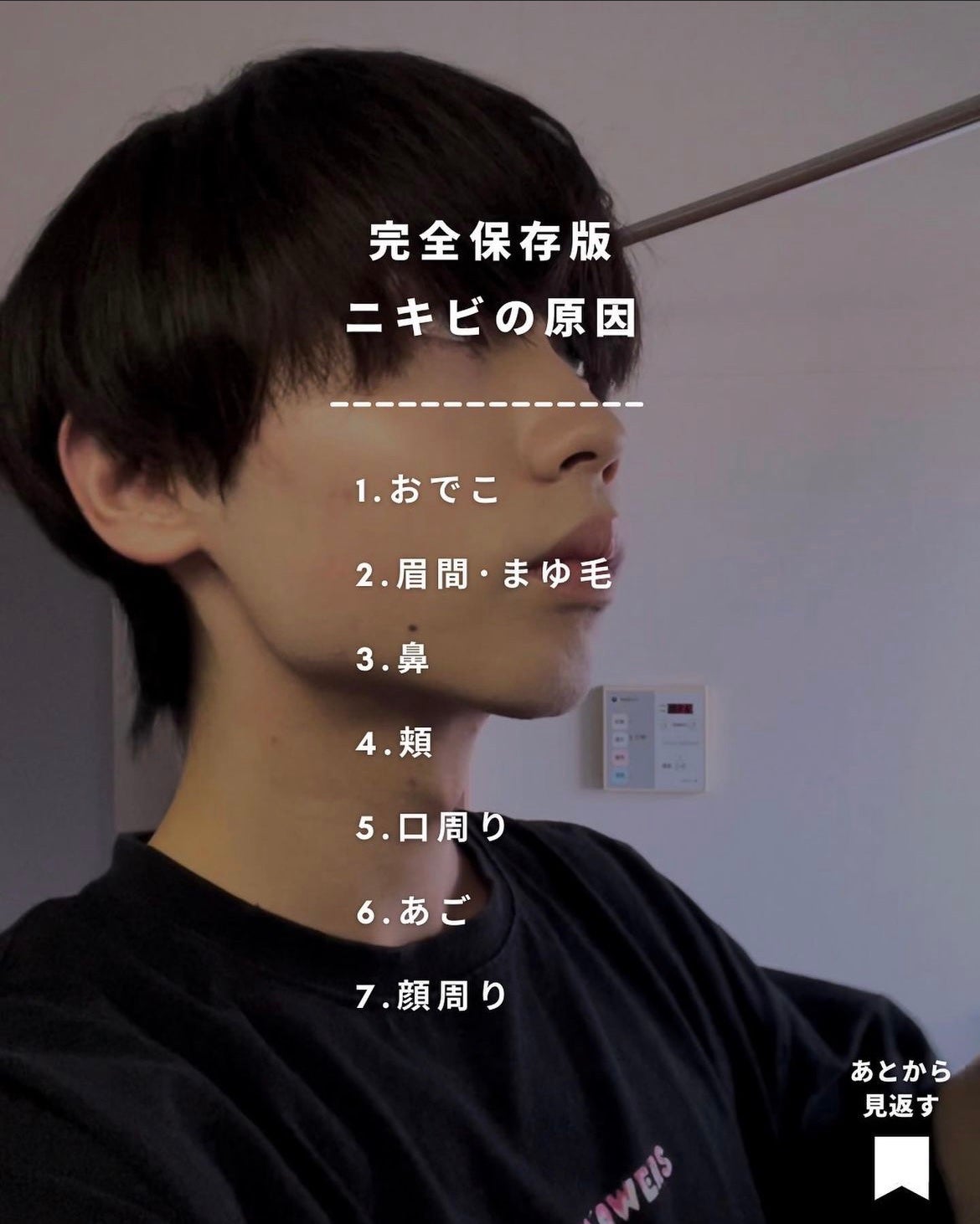 まえけん|ユニセックス美容 on LIPS 「【完全保存版!ニキビの原因7選】顔にニキビができた際に場所ごと..」(9枚目)